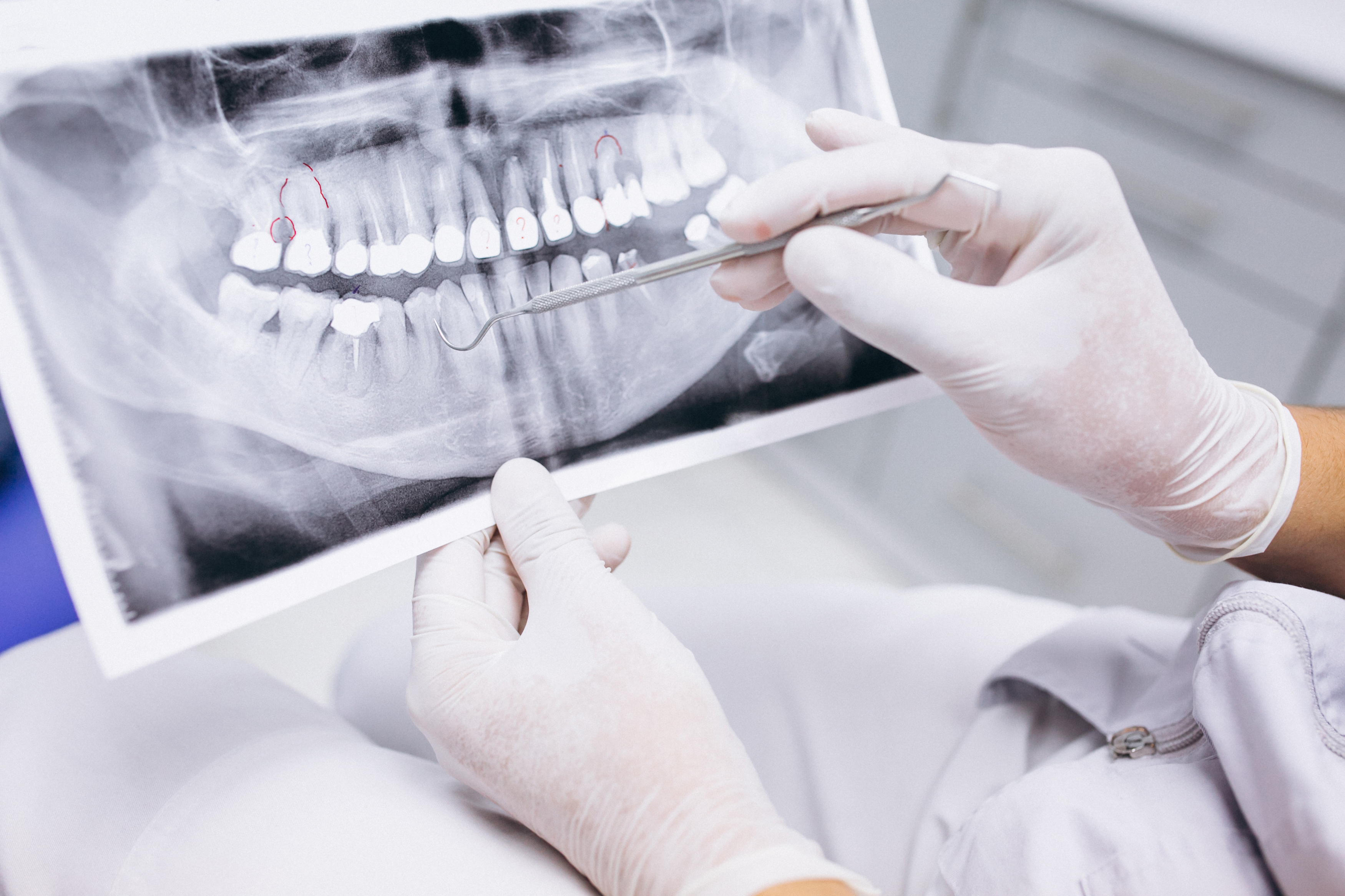 осложнения после протезирования зубов