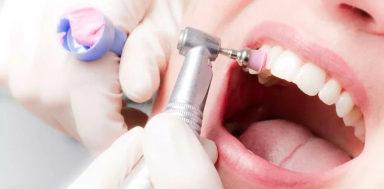 кто такой стоматолог гигиенист и какие услуги он оказывает?