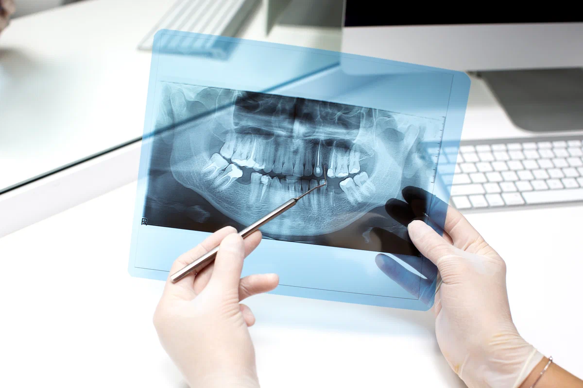 выбор между зубным протезированием и имплантацией