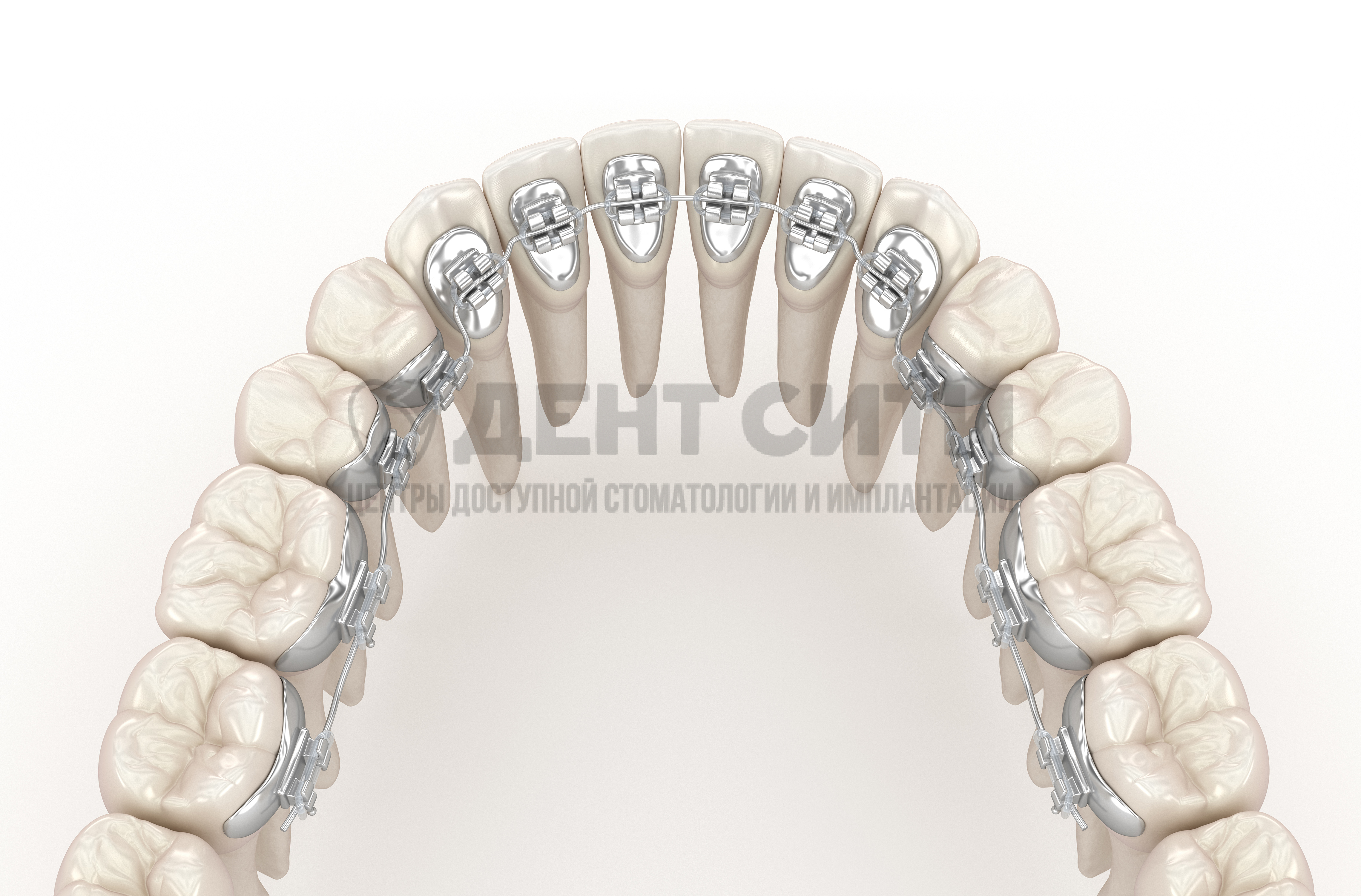 Ортодонтия и брекет-системы