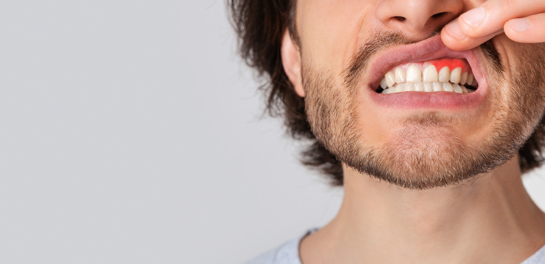 самые распространенные проблемы с зубами