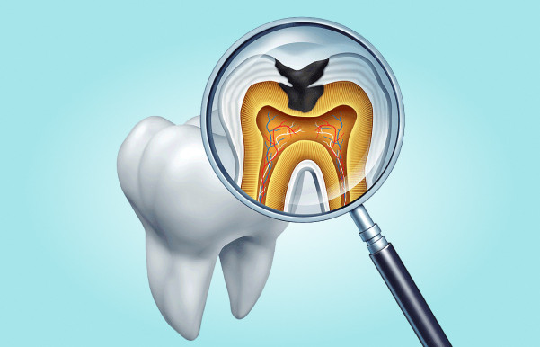 какие заболевания зубов самые распространенные?