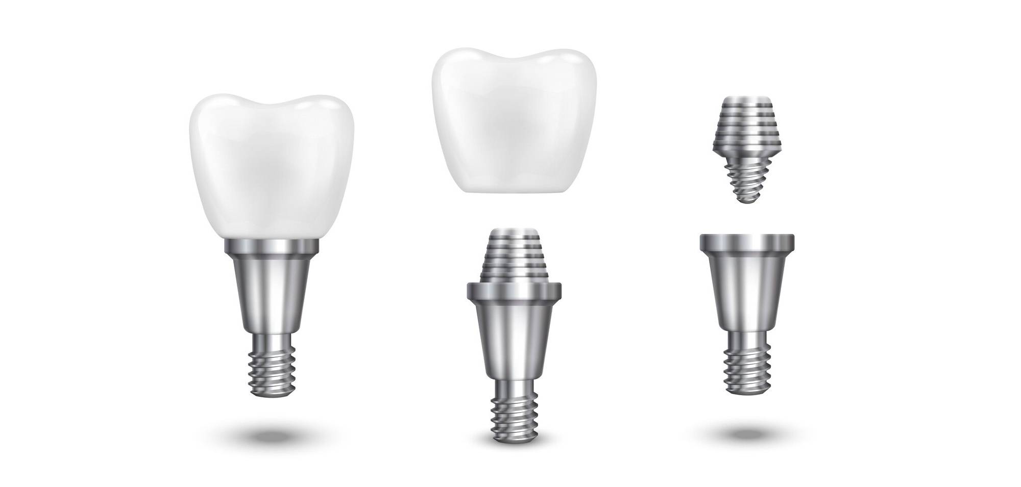 в чем разница между дорогими и дешёвыми зубными имплантами и из чего складывается стоимость имплантации зубов?