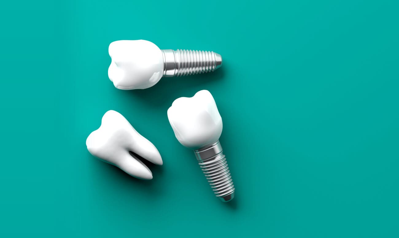 а есть ли недостатки у зубных имплантов?
