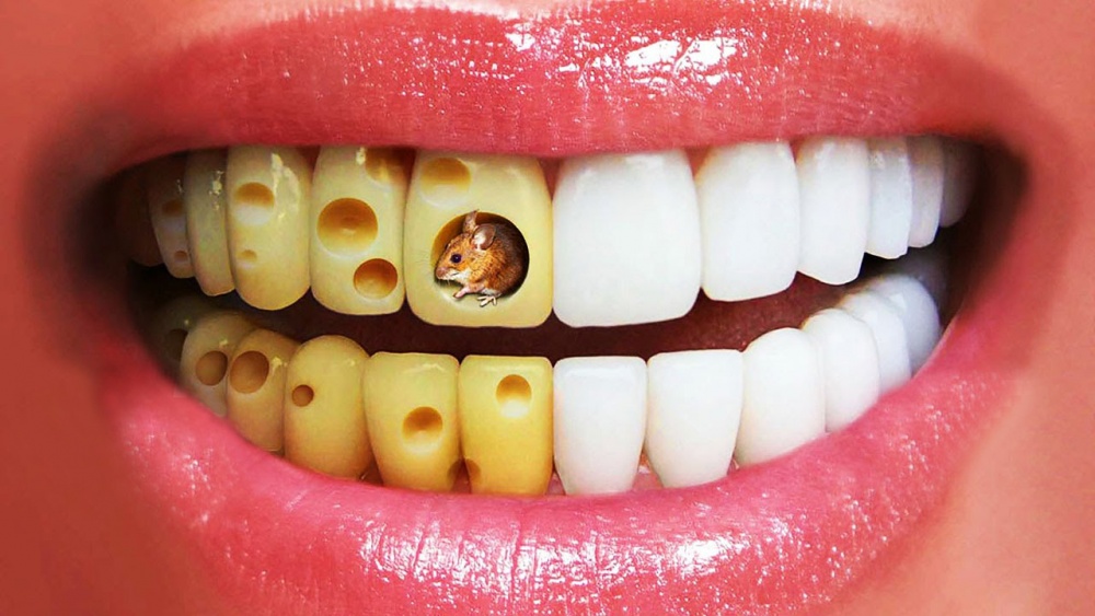 почему желтеют зубы?