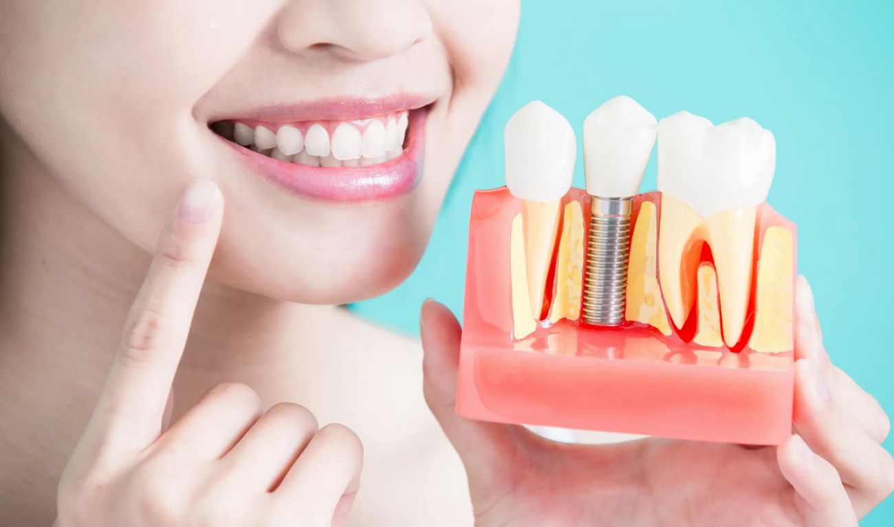 что можно есть после имплантации зуба?