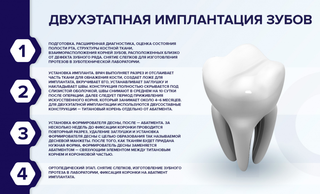 Двухступенчатая имплантация зубов