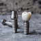мифы и заблуждения о зубных имплантатах: что нужно знать на самом деле