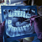 восстановление зубов после травмы: что нужно знать?