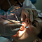 безболезненная стоматология в дент сити: миф или реальность?