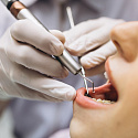 мифы о стоматологии. часть 1