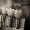 виды зубных имплантов: какой выбрать?