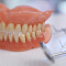 основные способы протезирования зубов