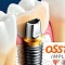 импланты osstem