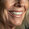 почему стоматологическая клиника «дент сити» является лидером в установке имплантов all-on-4 и all-on-6