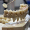 влияние больных зубов на весь организм